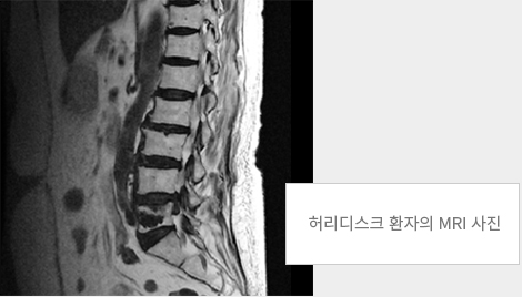 단순 방사선 검사, 전산화단층촬영(CT검사), 자기공명영상검사(MRI)