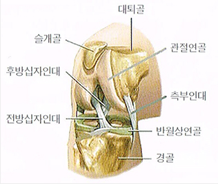 십자인대 파열