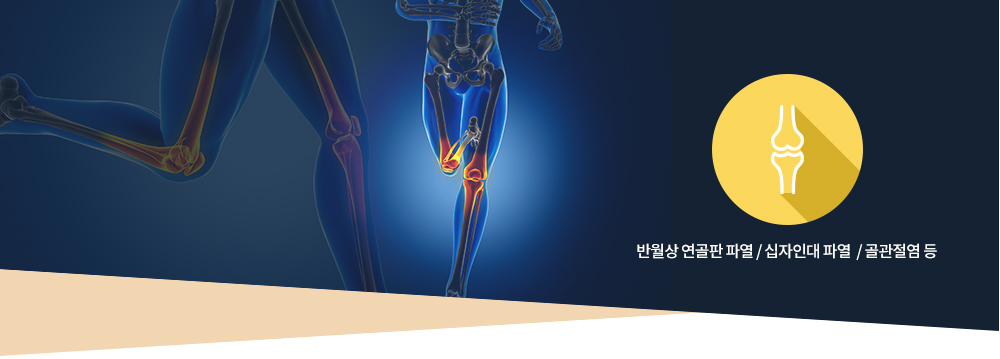 무릎질환 : 반월상 연골판 파열 / 십자인대 파열  / 골관절염 등
