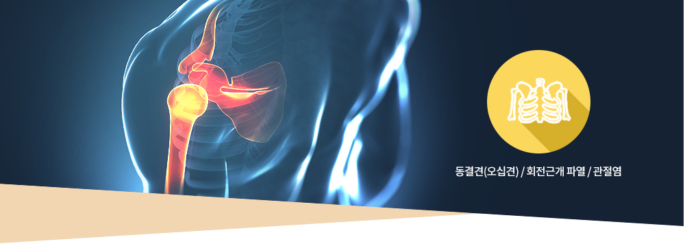 어깨질환 : 동결견(오십견) / 회전근개 파열 / 관절염